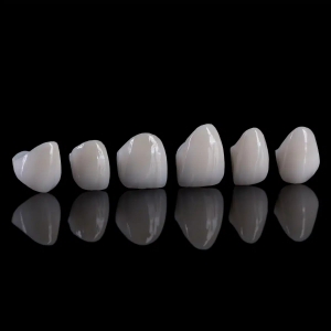 The Ultimate Guide to Getting Dental Crowns